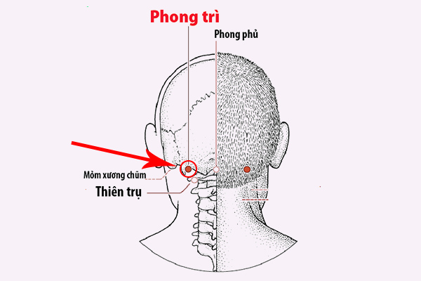 Phương pháp bấm huyệt Phong Trì điều trị ho kèm theo viêm họng