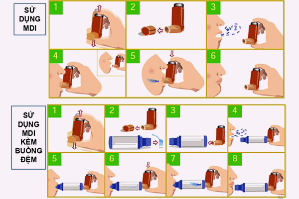 Hướng dẫn sử dụng MDI và MDI kèm buồng đệm