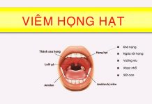 Viêm họng hạt